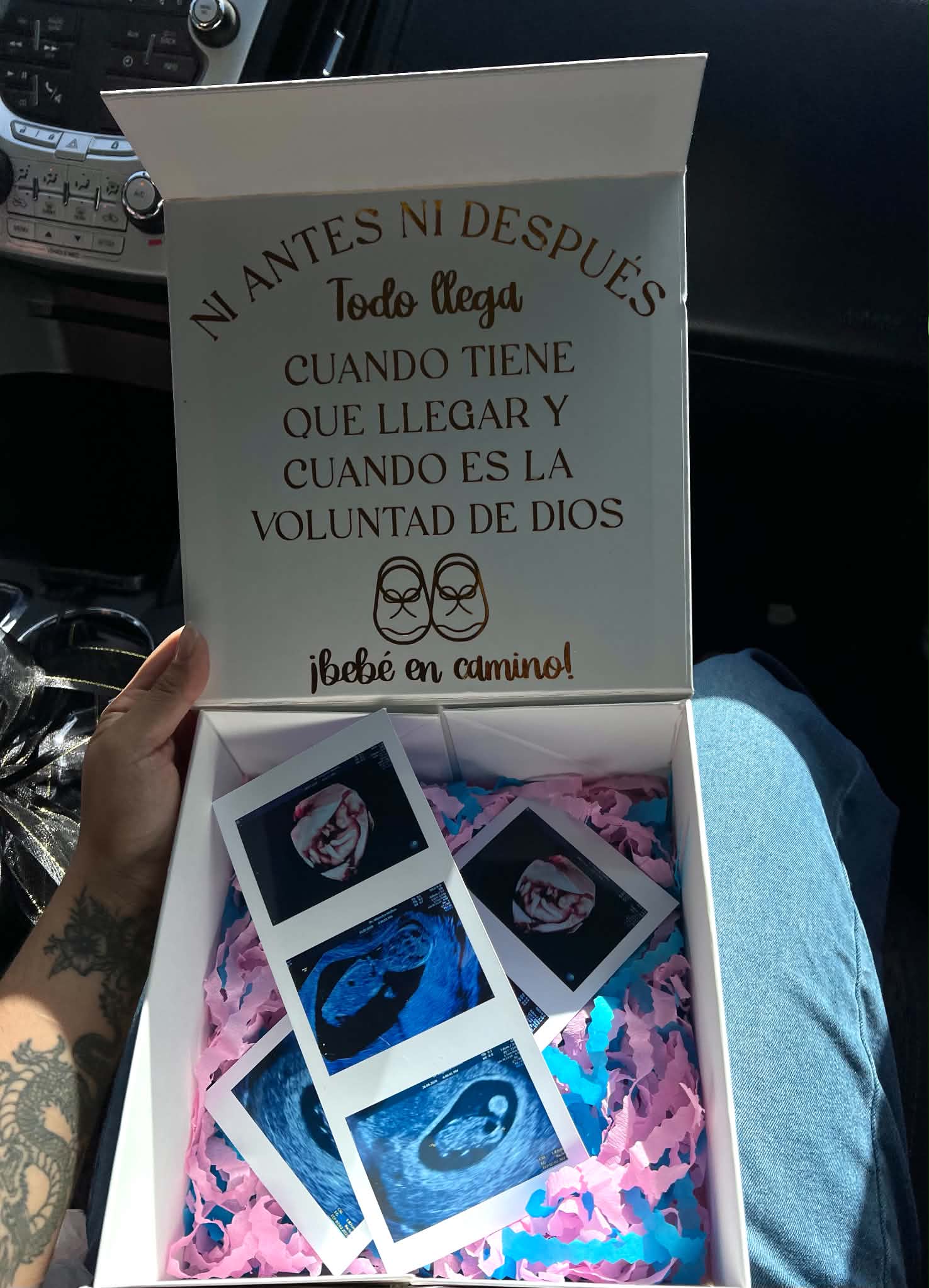 Caja de revelación con las fotos del ultrasonido